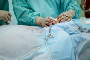 10 Key Benefits of Choosing Hernia Surgery and Repair at St. Peters' Benrus Surgical