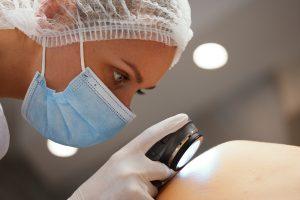 Skin Cancer Surgery | Options, Recovery, and Communication