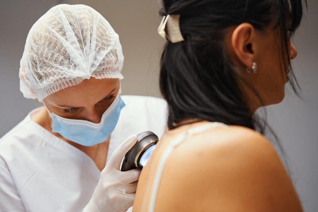 Skin Cancer Surgery St. Peters: Expert Care & Support Services