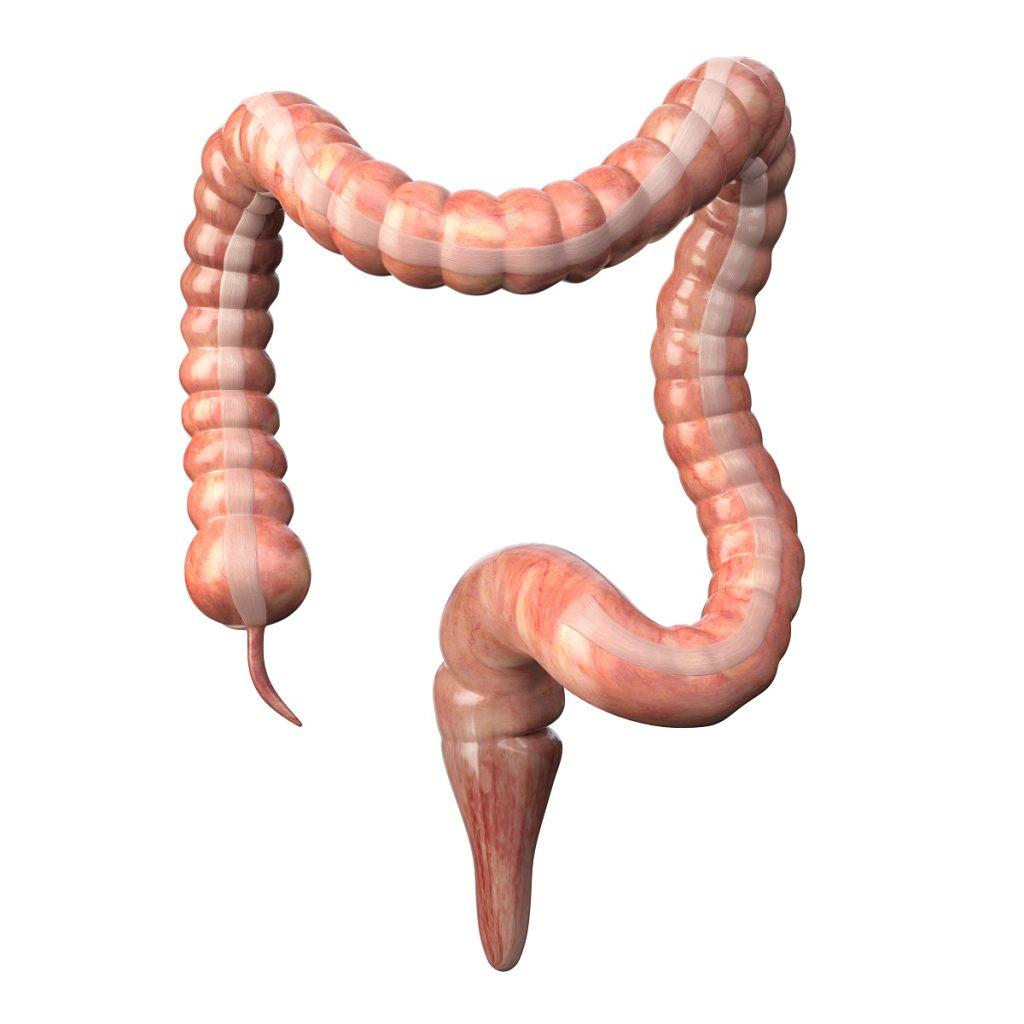 Colon and Rectal Cancer Surgery: Options and Expertise in Your Area