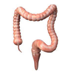 Colon and Rectal Cancer Surgery: Options and Expertise in Your Area