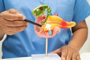 Gallbladder Removal St. Peters: Understanding the Procedure and Benefits