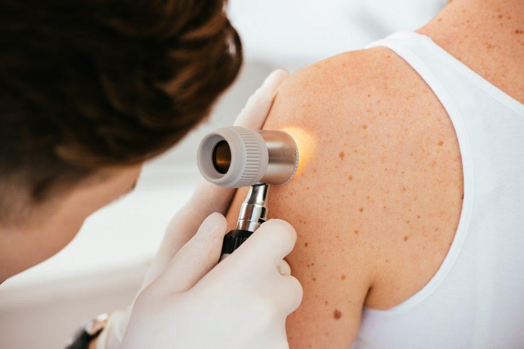 Skin Cancer Surgery St. Peters, MO: Expert Care and Support ...