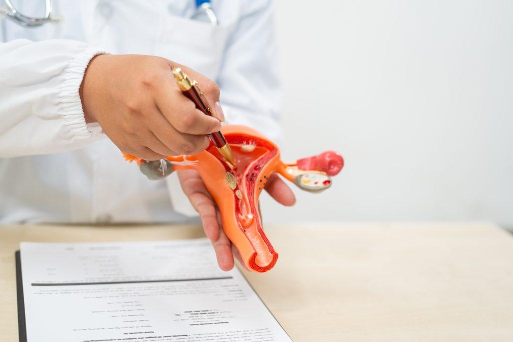 Hemorrhoid Treatment Options in St. Peters, MO - Local Clinics and Providers